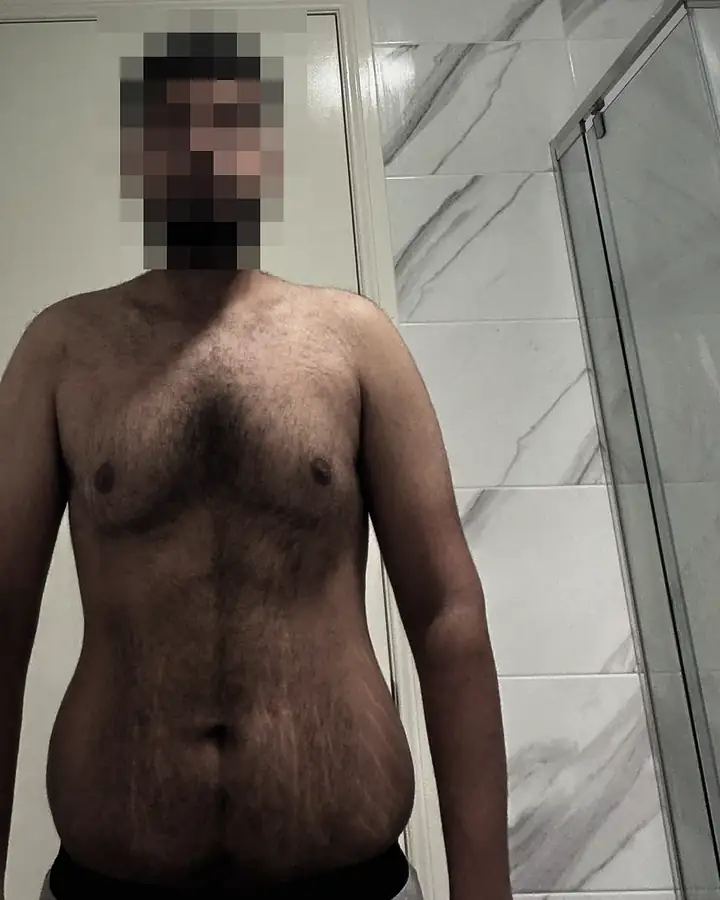 A client before starting with NEVER-LESS